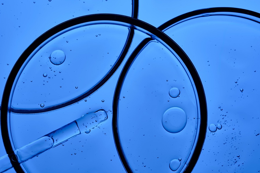 암 진단 정확도를 획기적으로 개선하는 지질단백질 제거 기반 엑소좀 분리 기술 개발 썸네일