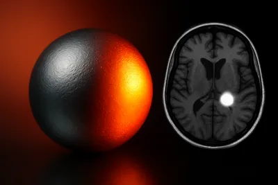 pH 반응형 MRI 조영제로 암을 조기 진단하는 기술 개발 썸네일