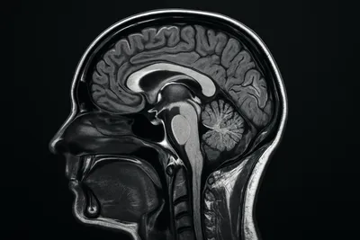 저독성 실리카 나노입자 기반 MRI 조영제 개발 썸네일